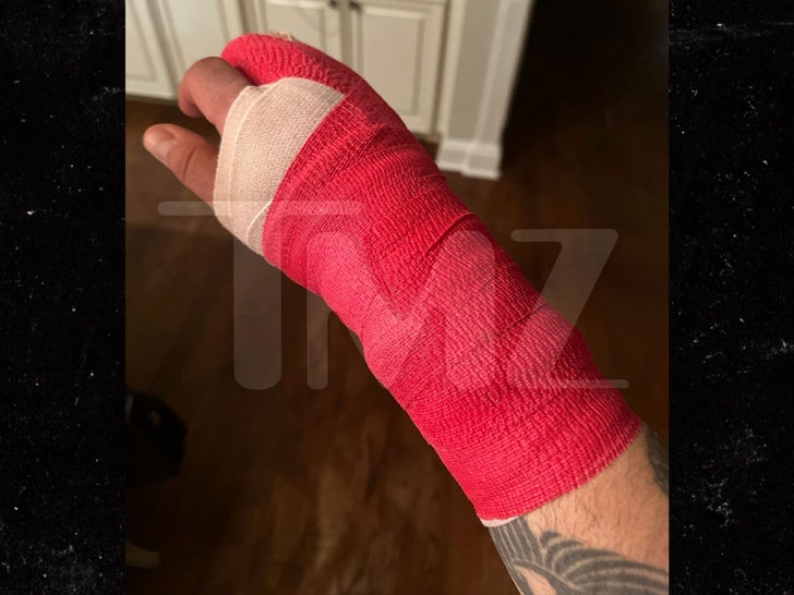 Chris Kirkpatrick broken hand watermark tmz