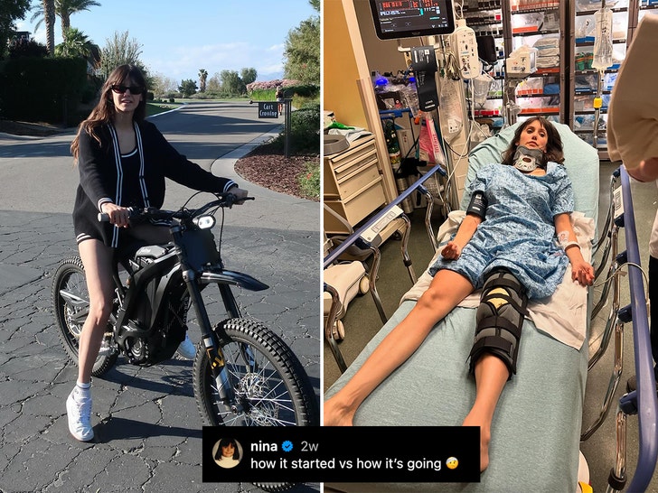 Nina Dobrev's bike surgery