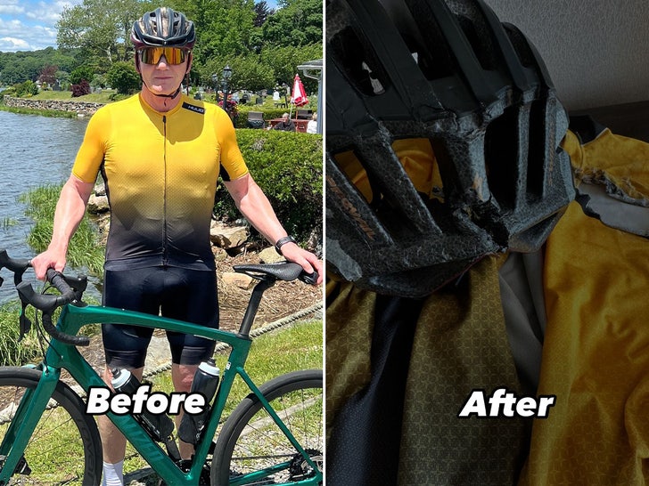 before after Gordon Ramsay's bicycle accident